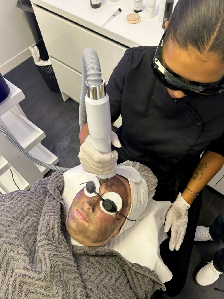 vrouw krijgt carbon peeling behandeling van huidspecialist