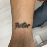 Tatoeage Verwijderen img 7841